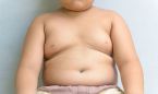 La obesidad afecta a la salud del hígado en niños hasta los 8 años