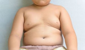 La obesidad afecta a la salud del hígado en niños hasta los 8 años