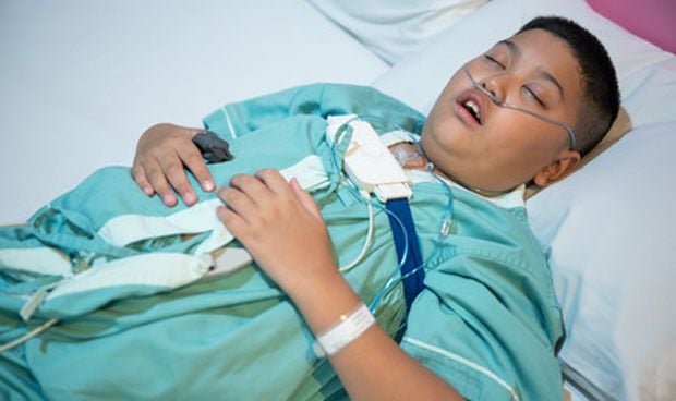 lanza temblor Chelín La obesidad es muy frecuente en los niños con apnea del sueño
