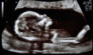 La organización de las redes cerebrales se establece durante el embarazo