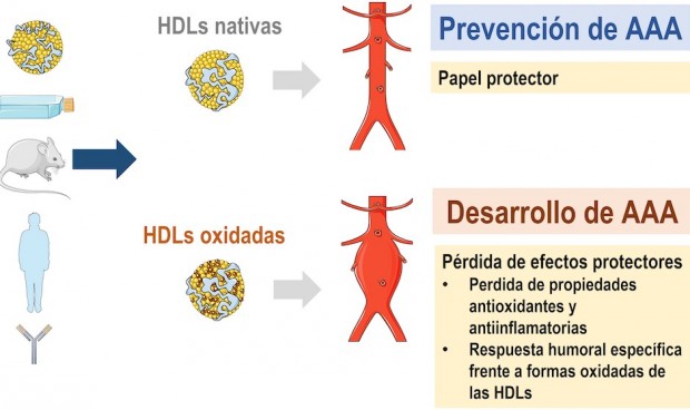 La oxidación de las lipoproteínas combate el aneurisma aórtico abdominal