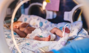 La Paz implanta un catéter pediátrico para fallo respiratorio grave