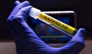 La pérdida temprana de inmunidad al Covid impide neutralizar variantes