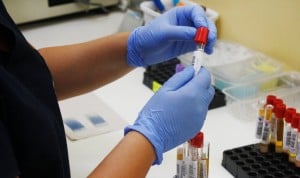 Analisis de sangre en laboratorio