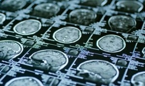 La salud mental cambia la investigación de las farmacéuticas