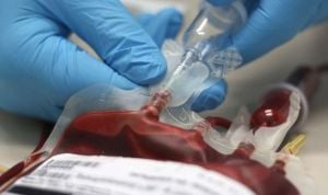 La sangre almacenada durante largo tiempo genera problemas en transfusión