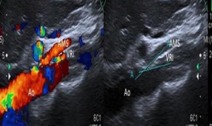 Estas son las ventajas de la ecografía Doppler dentro de la Radiología.