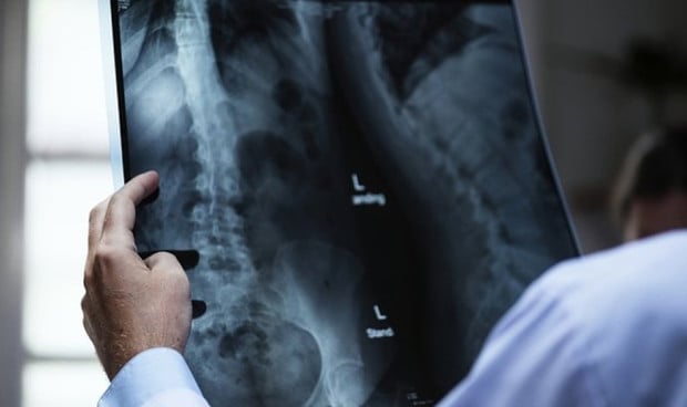 La Seram cree que la Radiología es clave para el tratamiento de la osteoporosis