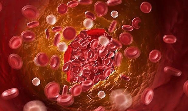 La terapia génica ofrece beneficios a largo plazo en hemofilia A