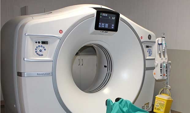 La tomografía computarizada ayuda a mejorar el tratamiento de la hemoptisis
