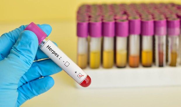 La vacuna contra el VIH 'esconde' mayor riesgo de infecciones cutáneas