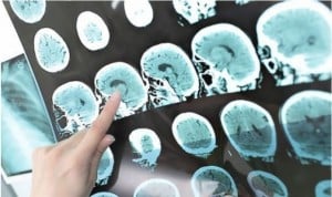 Nuevo indicador para conocer la salud cerebral en adultos
