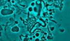 Las bacterias cambian de forma para no ser detectadas por antibióticos