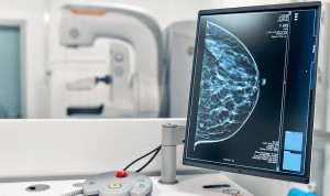 Las mamografías de nueva generación detectan antes el cáncer y radian menos