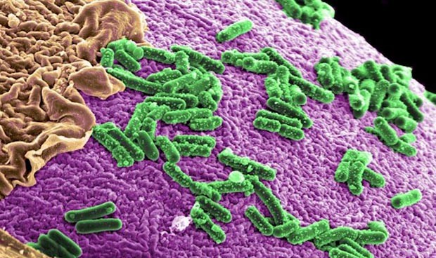 Las matemáticas desvelan el nexo entre una bacteria y el cáncer intestinal