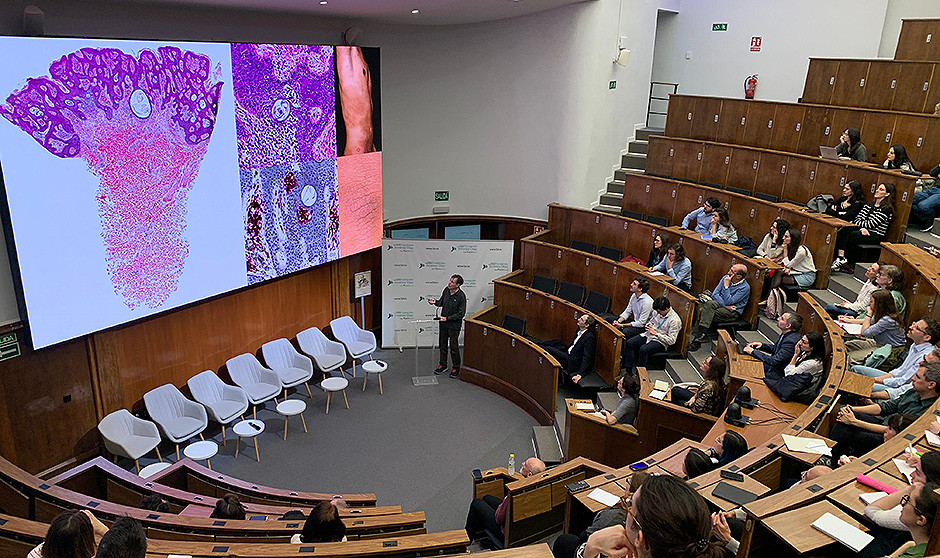 La Jornada sobre linfomas cutáneos revisa nuevas tecnologías diagnósticas