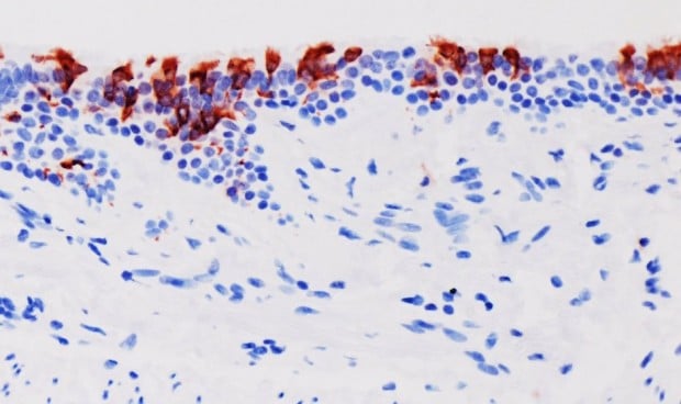 Coronavirus: ¿un electroestimulador puede realmente ponerme en forma  durante la cuarentena?