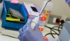 La tecnología de ARNm "puede cambiar la estrategia" para combatir el cáncer