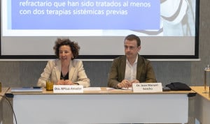 Roche desarrolla un fármaco contra el linfoma folicular más efectivo y menos tóxico que la quimioterapia