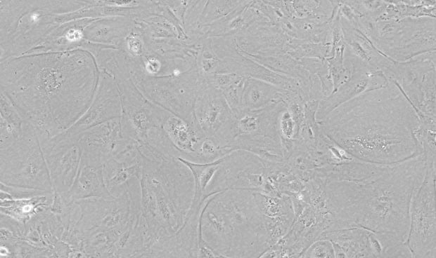 Logran disminuir en ratones el rechazo a trasplantes usando células madre