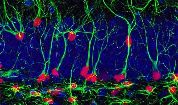 Los beneficios cognitivos del ejercicio físico se heredan