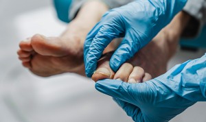 Los podólogos compartirán categoría A2 con Enfermería en su salto al SAS