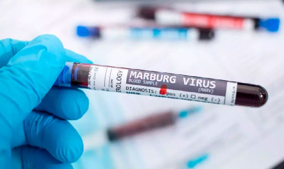 Diferencias y similitudes entre el virus del Ébola y el de Marburgo. 