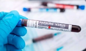 Los síntomas del virus Marburgo y por qué no es igual que el ébola