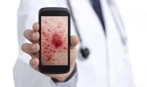 Los smartphones ayudan al dermatólogo a diagnosticar afecciones de la piel