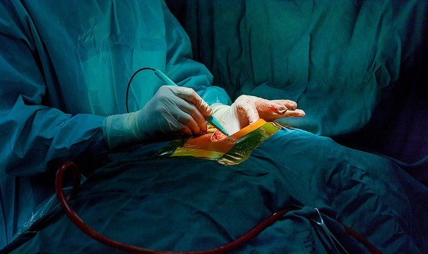 Los trasplantes de órganos de cerdos a humanos están cada vez más cerca