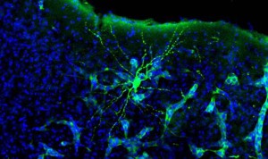 Metástasis en cerebro de ratón. 