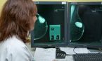Madrid aade la cita telefnica al programa de deteccin de cncer de mama
