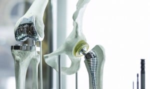 Madrid trabaja en injertos óseos 3D para reducir el número de cirugías