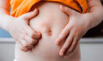 Más de 1.300 niños para dar con el mejor tratamiento de dermatitis atópica