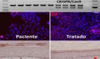 Mejoran la edición genómica para el tratamiento de la epidermolisis bullosa