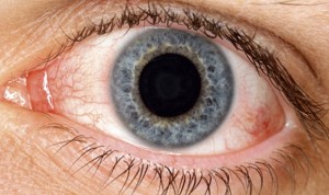 Miranza pone en marcha nuevas áreas especializadas en ojo seco 