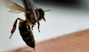 Muere una española por una pseudoterapia basada en picaduras de abeja