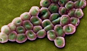 Muere una mujer por una bacteria resistente a todos los antibióticos