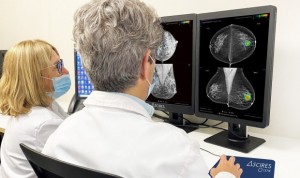 Mujeres mayores de 70, más propensas al sobrediagnóstico de cáncer de mama