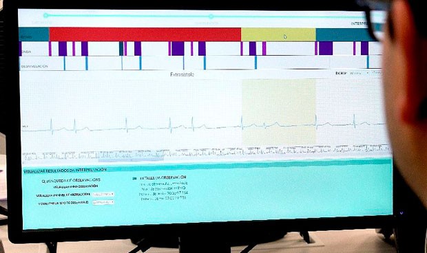 Nace el sistema "más preciso del mundo" en interpretar electrocardiogramas