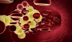 Nuevas terapias logran reducir el colesterol LDL en hipercolesterolemia