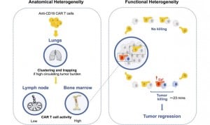 Observan por primera vez cómo luchan las CART contra un cáncer de sangre