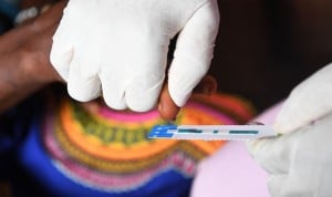 OMS: La prueba rápida de VIH es más barata y precisa que las tradicionales