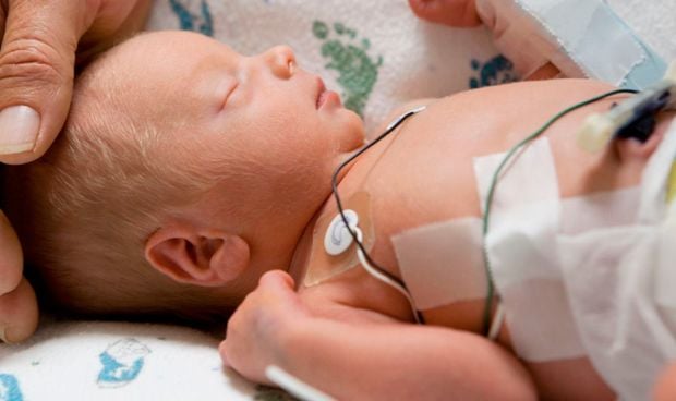 Operación pionera para curar la grave arritmia de un bebé prematuro