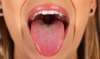 Perder grasa en la lengua mejora la apnea obstructiva del sueño