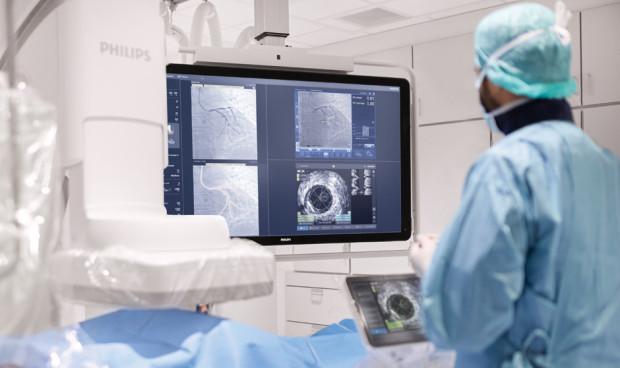 Philips adquiere SpectraWAVE para impulsar la imagen coronaria y la IA