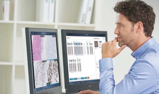 Philips e Ibex Medical se unen para acelerar la patología digital con IA