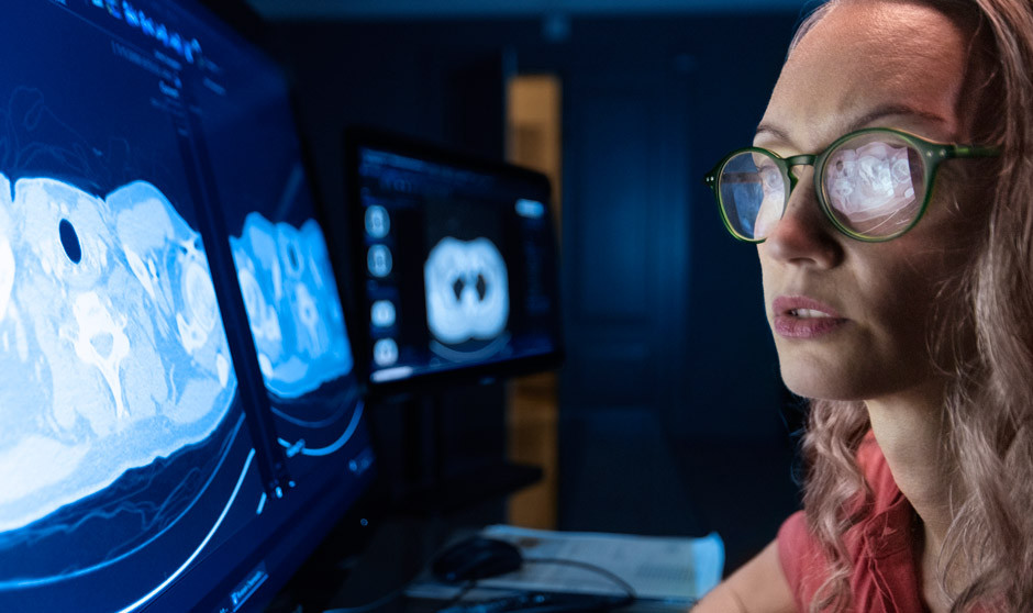 El avance de la IA en radiología se encuentra en un punto de inflexión, según Philips