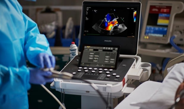 Philips lanza un nuevo sistema de ultrasonidos para el diagnóstico precoz