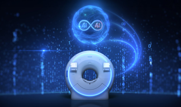 La solución de Philips y Nvidia se integrará de manera fluida en los flujos de trabajo actuales de resonancia magnética.